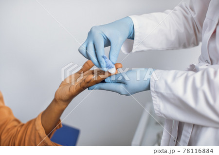 Close up cropped photo of hands of a female lab worker in white coat and gloves, taking a patient's blood sample, using painless scarifier. Black woman patient ready to blood test. 78116884