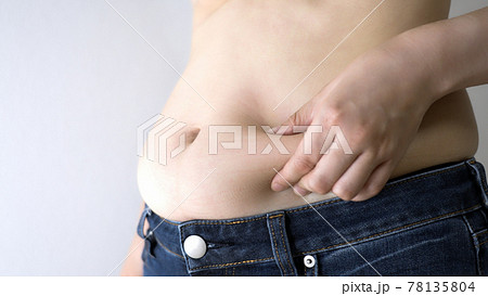 贅肉を摘む太った女性 78135804