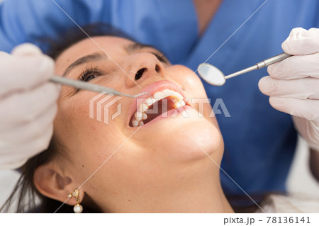 Medical checkup oral cavity of female patient 78136141