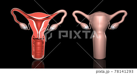 子宮解剖図 78141293