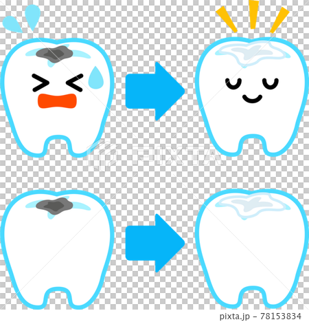 齲齒和塞牙字符 78153834