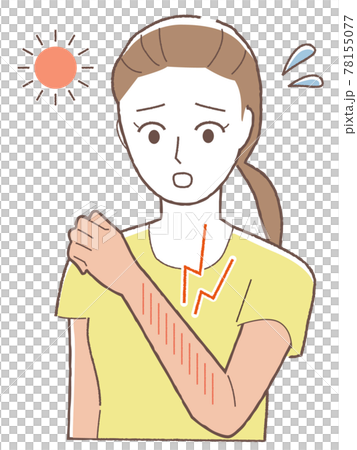 A woman who has tanned her arm 78155077