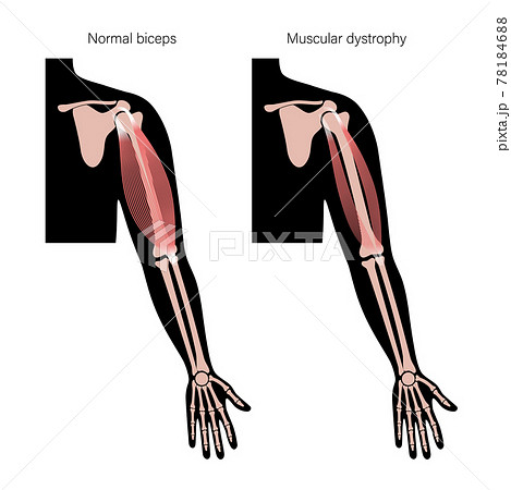 Human arm muscles Human arm muscles 78184688