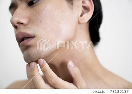 美容に悩む男性のポートレート 78189157
