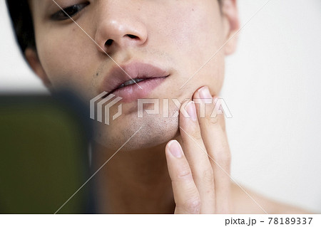 美容に悩む男性のポートレート 78189337