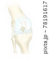 膝関節 78191617