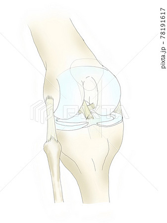 膝関節 膝関節 78191617