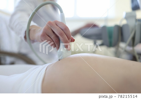 Uzist doctor conducts medical examination of pregnant woman 78215514