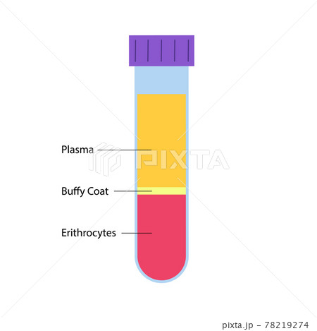 Platelet rich plasma concept 78219274