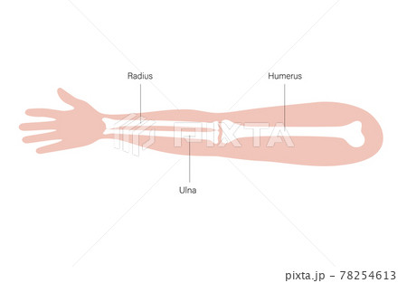 Arm bones poster Arm bones poster 78254613