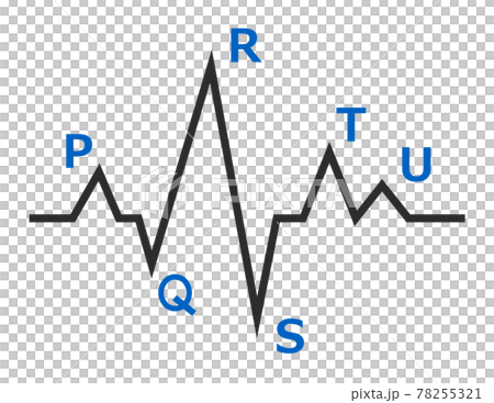 檢查心臟波長的心電圖圖示 檢查心臟波長的心電圖圖示 78255321