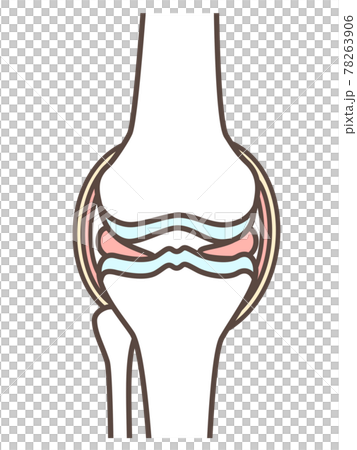 正常な膝関節の簡易イラスト 78263906