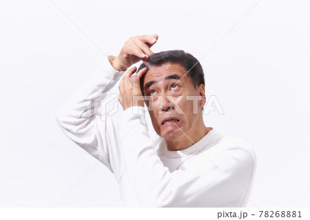 ヘアケアに悩むシニア男性 ヘアケアに悩むシニア男性 78268881