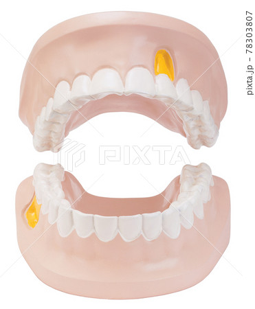 Dentures with bright teeth and mouth open 78303807