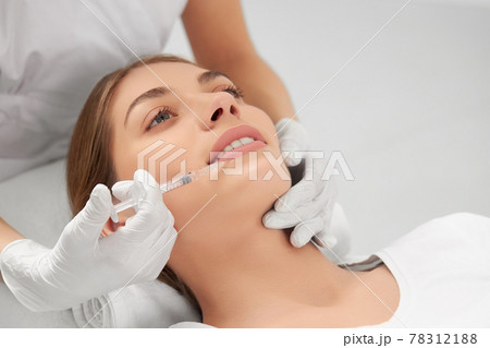 Young woman on procedure lip augmentation. Young woman on procedure lip augmentation. 78312188