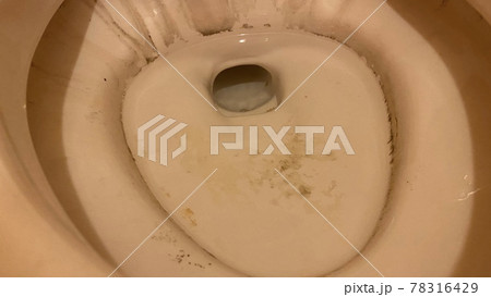 洋式トイレの便器の黒ずみ 78316429