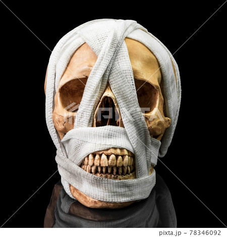 Human skull with bandage 78346092