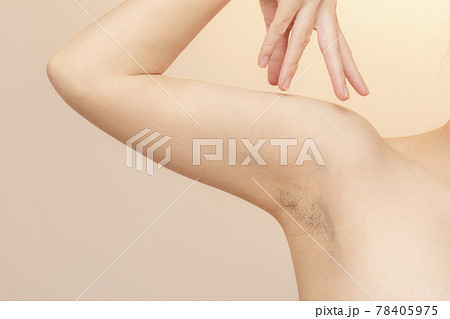 日本の若い女性の脇毛 日本の若い女性の脇毛 78405975