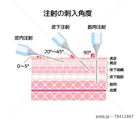 注射の刺入角度の違い ベクターイラスト 筋肉注射 皮下注射 新型コロナワクチンのイラスト素材