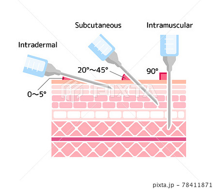注射の刺入角度の違い ベクターイラスト 筋肉注射 皮下注射 新型コロナワクチン 英語 のイラスト素材