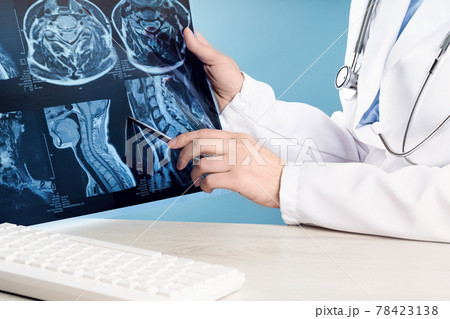 Female doctors hand pointing at x-ray medical imaging at a shoulder condition Female doctors hand pointing at x-ray medical imaging at a shoulder condition 78423138