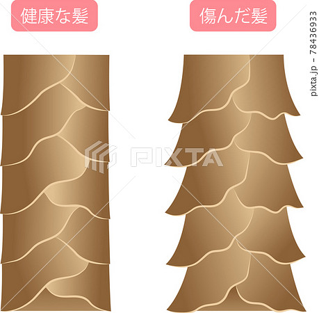健康な髪　傷んだ髪　キューティクル 78436933