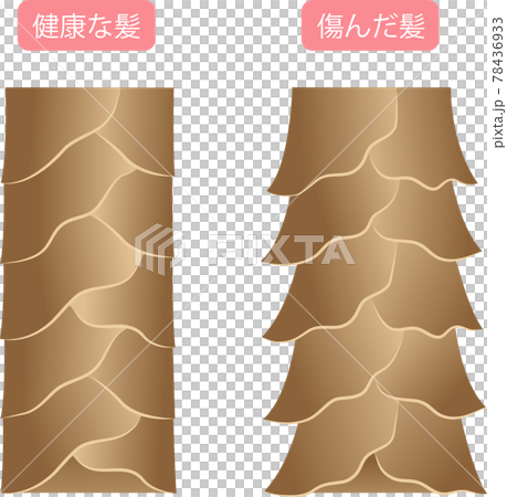健康な髪　傷んだ髪　キューティクル 78436933