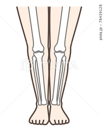 正常な足 脚 膝の病気の解説用イラスト のイラスト素材