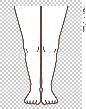 解釋正常腳和膝蓋疾病的插圖 78439228