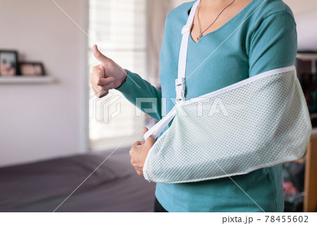 Patient woman wearing arm sling for relieve broken arms at home 78455602