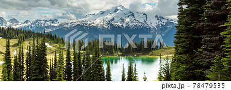 Image lake Image lake 78479535