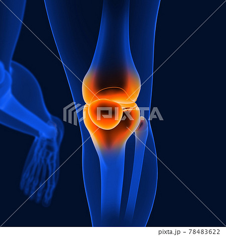 3D_Illustration_Knee_painful_human_skeleton_medical_concept_front_angle 78483622