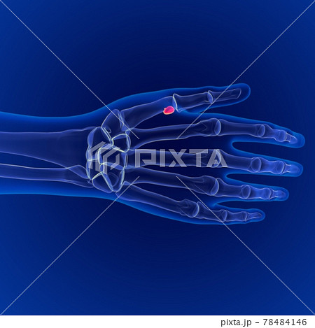 Human skeleton anatomy Sesamoid Bones 3D Rendering For Medical Concept 78484146