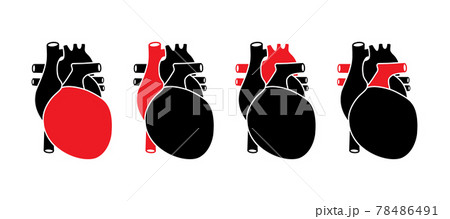Human heart with red selected parts. Anatomically correct organ illustration. Human heart with red selected parts. Anatomically correct organ illustration. 78486491