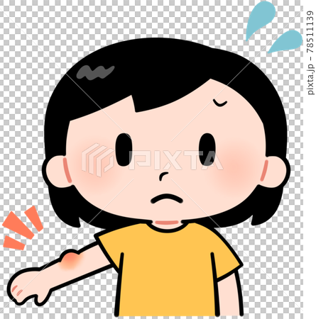 腕が腫れている女の子 腕が腫れている女の子 78511139