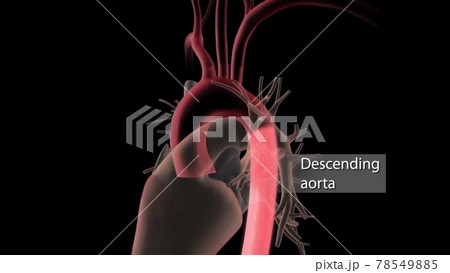 Abdominal aortic aneurysm. Arterial circulatory system of the abdominal. Healthy abdominal aorta and abdominal aorta with aneurysm. illustration in flat style isolated on black background Abdominal aortic aneurysm. Arterial circulatory system of the abdominal. Healthy abdominal aorta and abdominal aorta with aneurysm. illustration in flat style isolated on black background 78549885