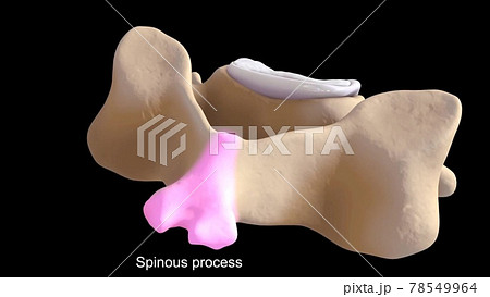 anatomically correct 3d view of intervertebral disc cervical spine spinous process 78549964