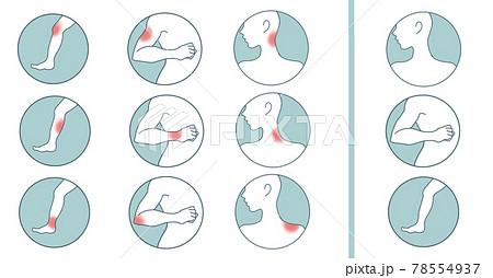 ケガ・肉離れのセットイラスト (透過png) ケガ・肉離れのセットイラスト (透過png) 78554937