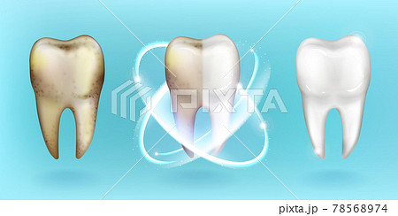 Clean and dirty tooth, whitening or clearing teeth Clean and dirty tooth, whitening or clearing teeth 78568974