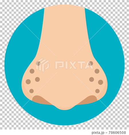 Dirty illustration of nose pores, darkening of the nose, flat design Dirty illustration of nose pores, darkening of the nose, flat design 78606508