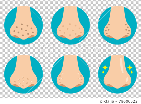 鼻の毛穴の汚れのイラストアイコン　フラットデザイン 78606522