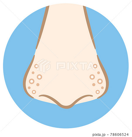 小鼻の毛穴の白い角栓汚れ 手描き風のイラスト素材