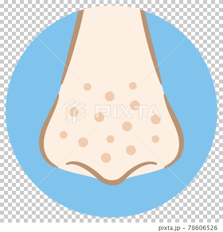 手描き風の鼻の汚れイラスト　そばかす　シミ　クレーター　いちご鼻　ニキビ跡 78606526