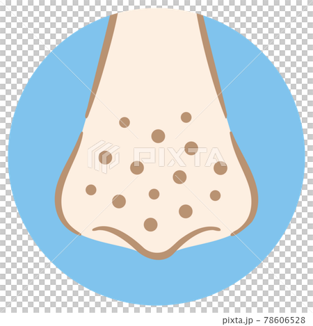 鼻孔臟圖草莓鼻子手繪風格 78606528