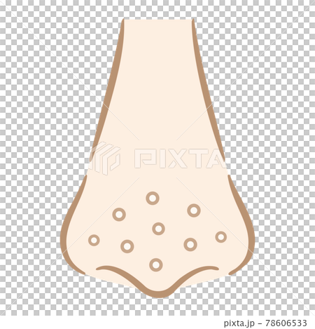 鼻の毛穴の白い角栓汚れ　手描き風 78606533