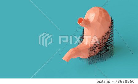 3d illustration of low poly human stomach repair concept 3d illustration of low poly human stomach repair concept 78628960