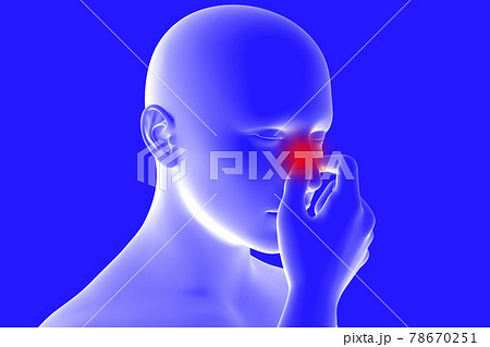 鼻水　鼻詰まり 78670251