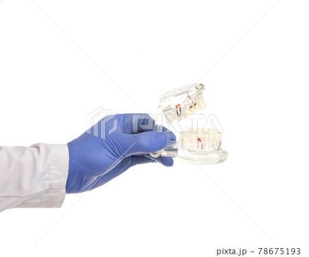 Doctor dentist holds in his hand on a white background a mock-up of a human dental jaw, isolate. Dental treatment concept in dentistry 78675193