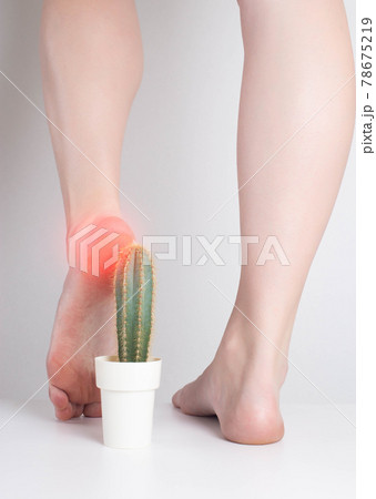 The girl steps on the cactus with her foot. The concept of pain in the sole and heel, metabolic disorders, gout The girl steps on the cactus with her foot. The concept of pain in the sole and heel, metabolic disorders, gout 78675219
