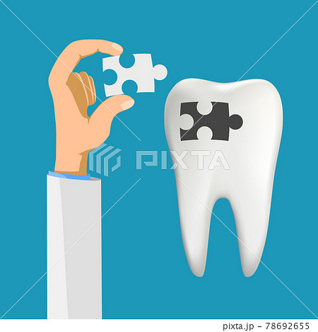 Human tooth with a hole caries. Tooth filling. 78692655